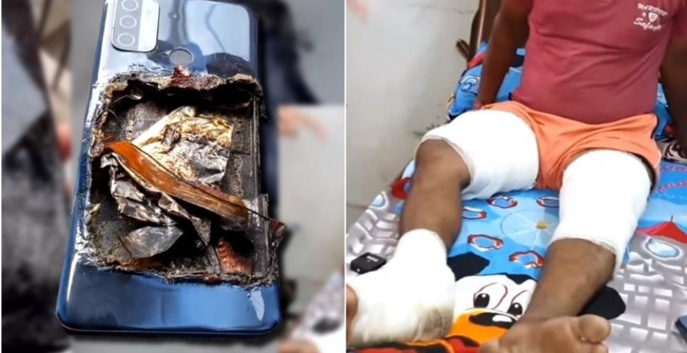 FOTO/VIDEO: Bărbat, rănit după ce i-a explodat smartphone-ul în buzunar. Modelul, vândut și în Moldova